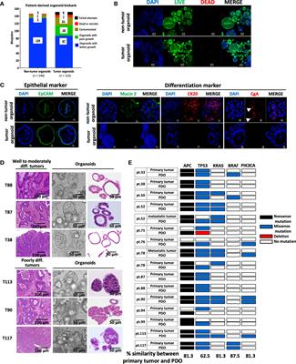 Patient-Derived Organoid Serves as a Platform for Personalized Chemotherapy in Advanced Colorectal Cancer Patients